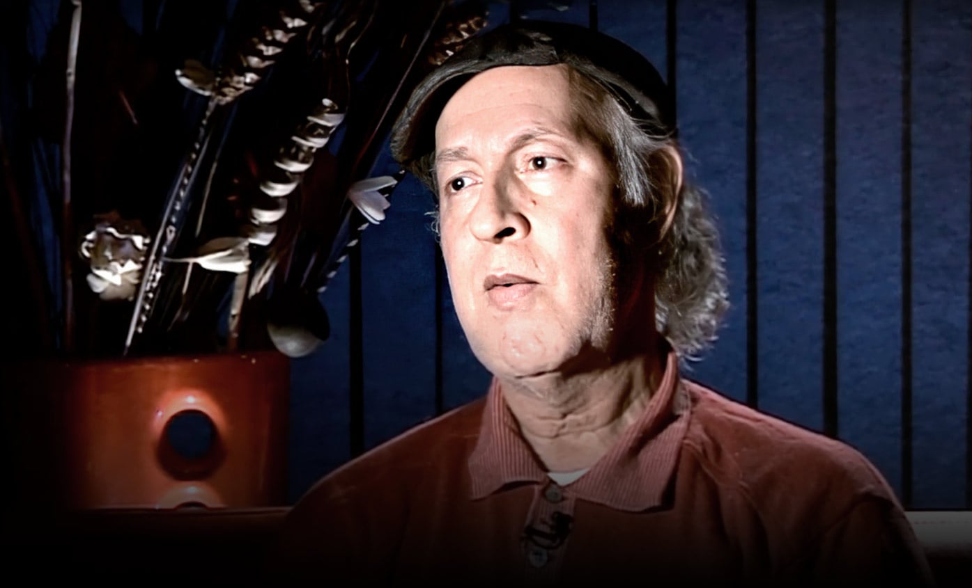 صورة حلقة المحتوى