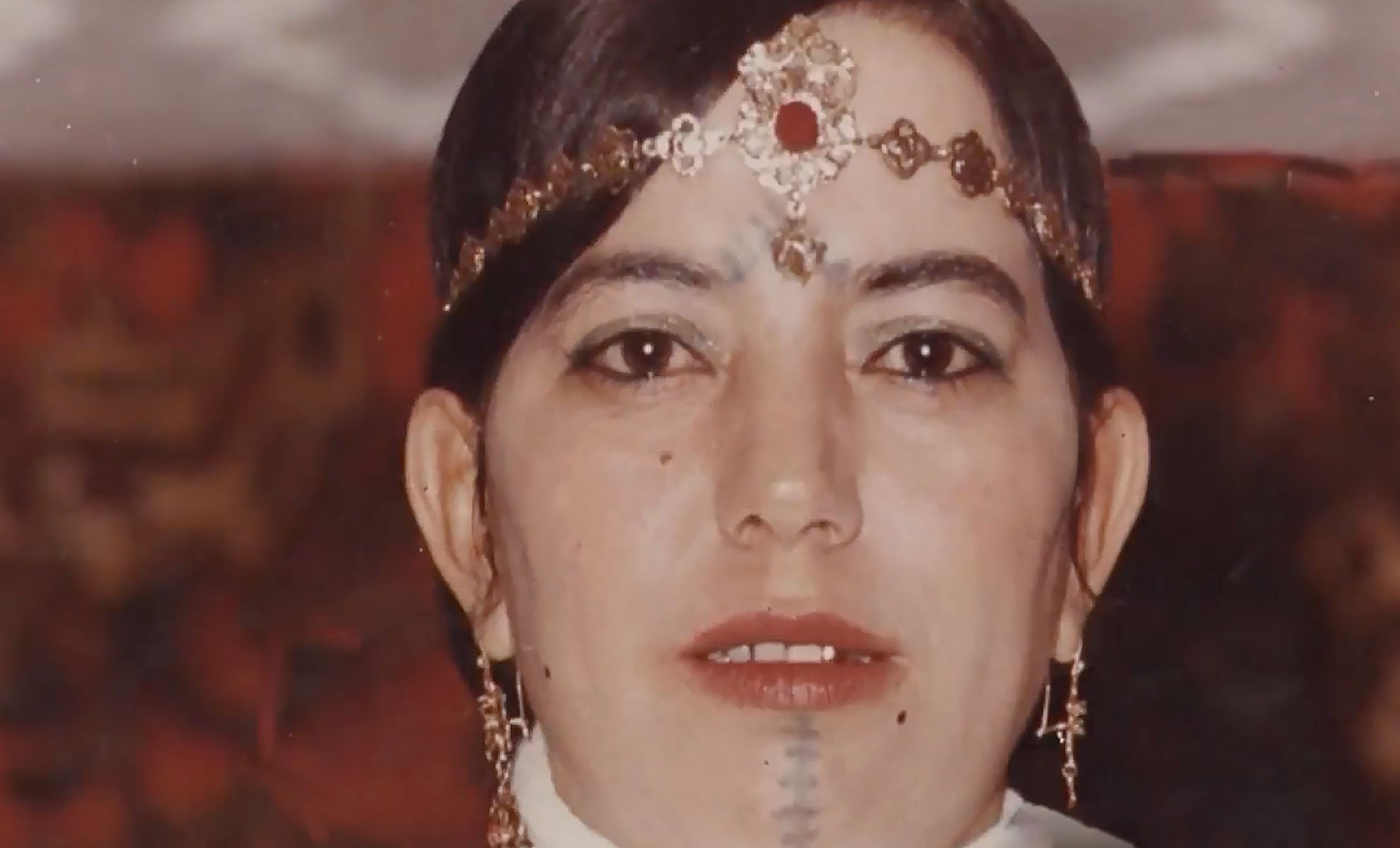 صورة حلقة المحتوى